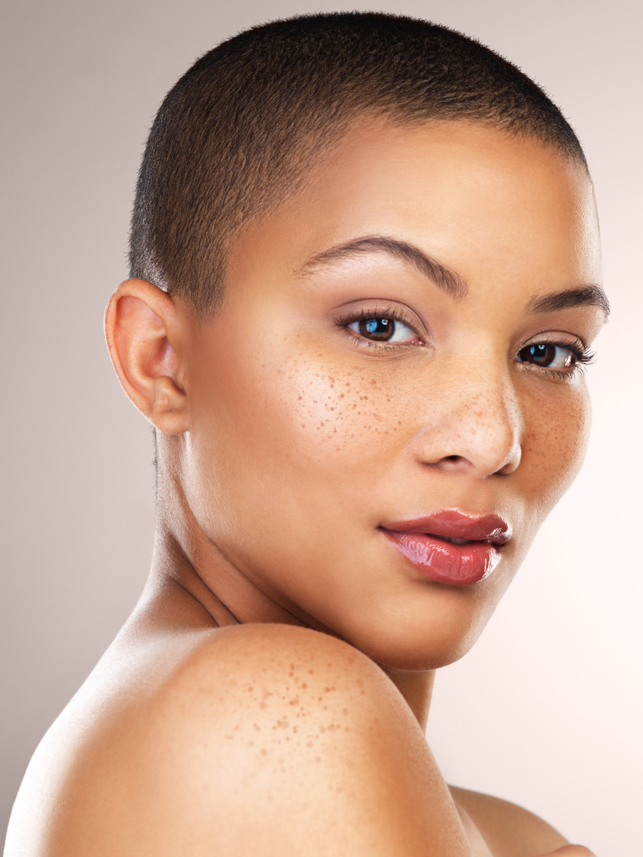 Laser Treatments
